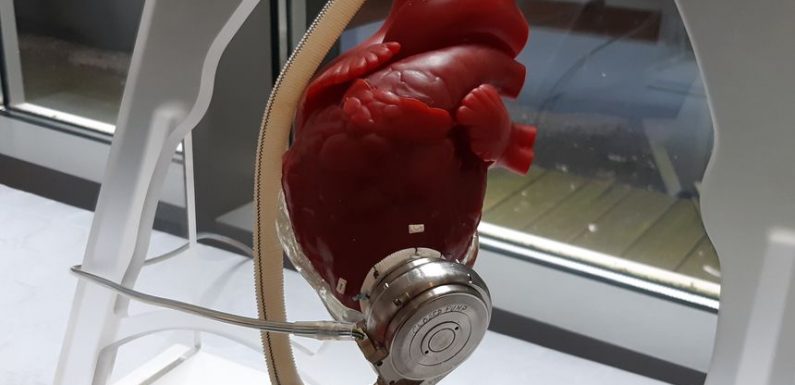 Sept ans avec une assistance cardiaque : un patient du CHU de Nancy bat un record de longévité en France