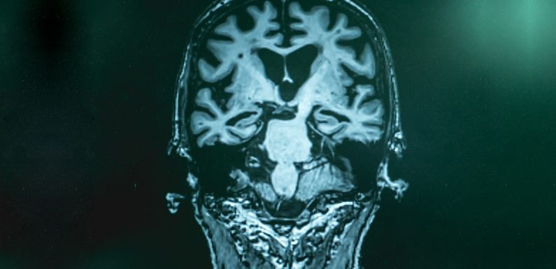 « Avoir une signature biologique de la présence de lésions ne signifie pas que l’on va développer la maladie d’Alzheimer »
