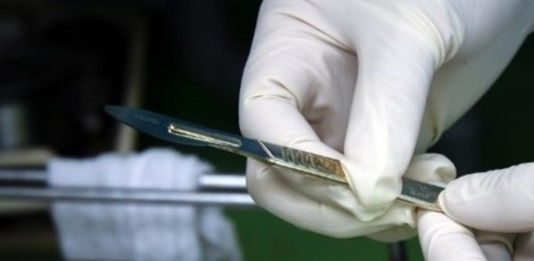 Il refuse la circoncision, le Tribunal lui donne raison