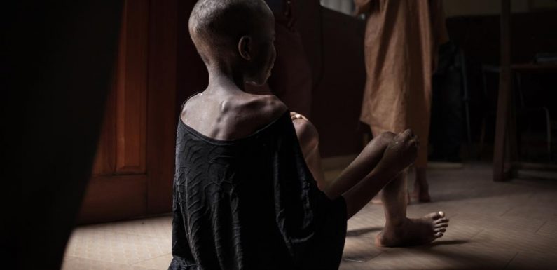 Santé: un jeune enfant sur trois est mal nourri ou en surpoids selon l’Unicef