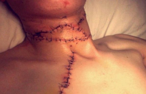 Il tranche la gorge de son fils parce qu’il est gay