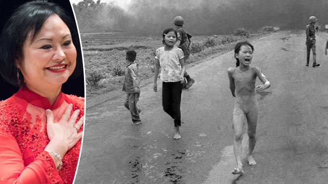 Happée par les flammes, « la petite fille au napalm » avait ému le monde en 1972: 47 ans après, Kim Phuc témoigne