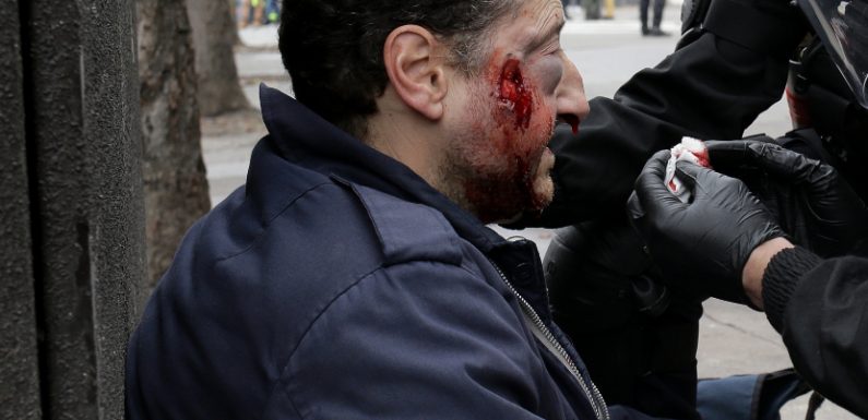 Violences policières contre des journalistes: Comment en est-on arrivé là ?