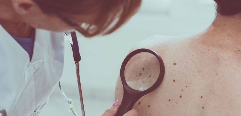Advanced melanoma: Dual drugs increase survival of ‘untreatable’ cancer – study