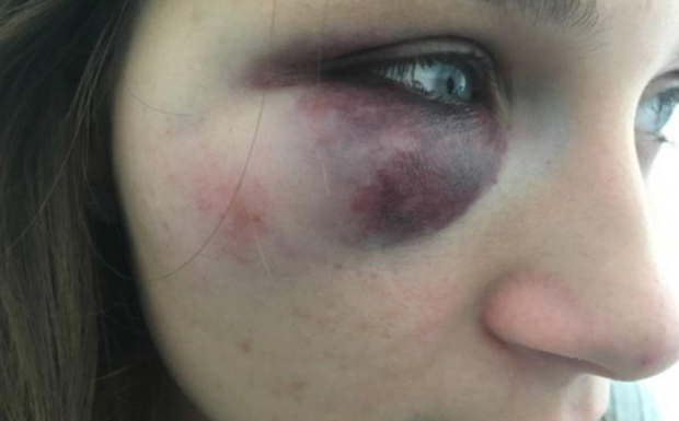 Thonon (74): elle lance un appel à témoins pour retrouver l’agresseur de sa fille… Ramzy démasqué