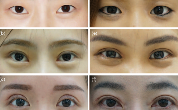 « Les populations aux yeux bridés feraient davantage d’enfants car elles seraient esthétiquement appréciées »