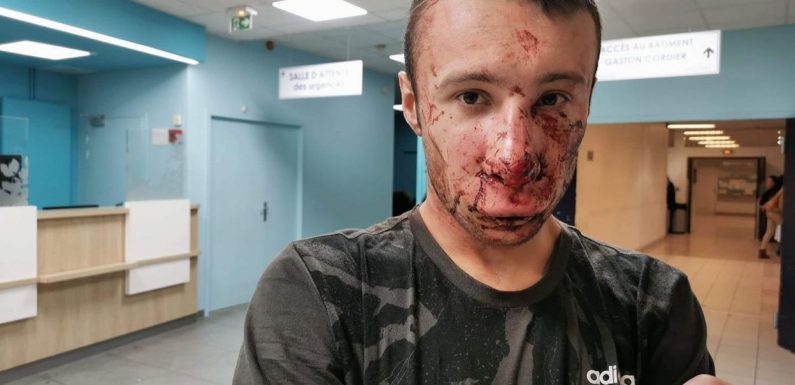 Gilets jaunes: un journaliste atteint au visage par une grenade à Paris, le vrai du faux