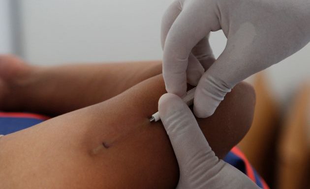 Une association alerte après deux cas d’implants contraceptifs retrouvés dans les poumons