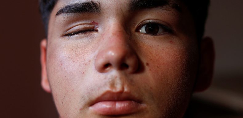 Chili : les forces de l&rsquo;ordre suspendent l&rsquo;utilisation des balles en caoutchouc