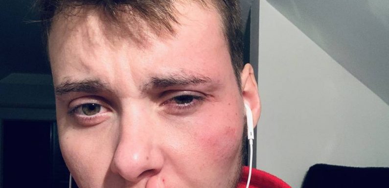 Besançon : Un étudiant trans agressé pour la troisième fois à l’Université