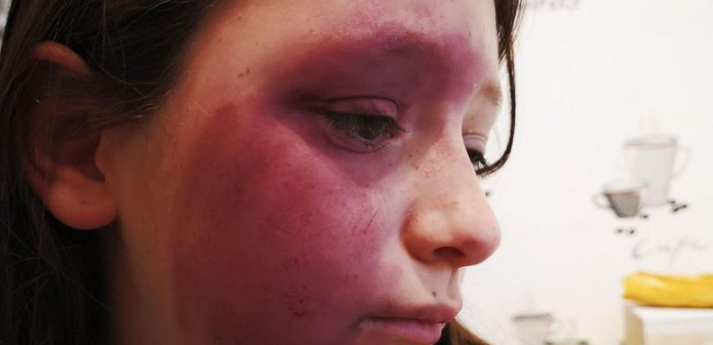Oise : Tallia, 10 ans, rouée de coups au collège