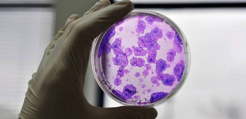 Une nouvelle molécule ouvre la voie à une greffe prometteuse pour les patients atteints de cancer du sang