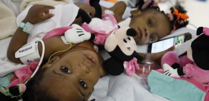 Sœurs siamoises séparées à Lyon : une des petites filles va être opérée du cœur