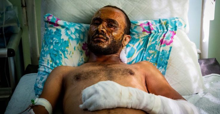 Exclusive Photos: Turkey Is Accused of Using Restricted Weapons in Syria, These 10 Pictures May Be Evidence