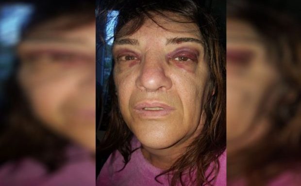 Clermont-Ferrand : une transgenre tabassée sous une pluie d’insultes par une dizaine d’hommes dans un « quartier sensible »