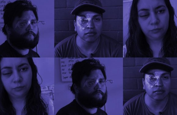 VIDEO. « Ils veulent nous rendre aveugles » : au Chili, des manifestants éborgnés dénoncent les violences policières