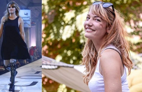 Handicap : malgré les amputations, elle est devenue mannequin