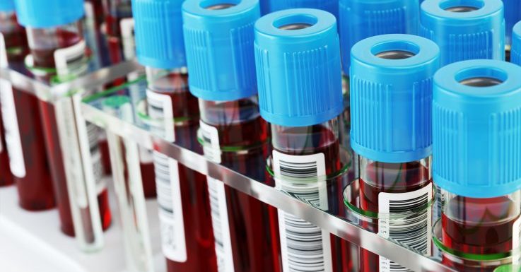 2% of U.S. Export Income Comes From Selling Blood