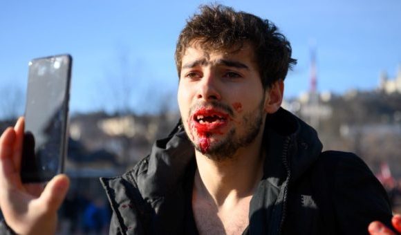 Arthur, 23 ans : « Des policiers m’ont cassé la gueule, littéralement »