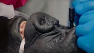 Steady-handed doctor performs first eye operation on gorilla