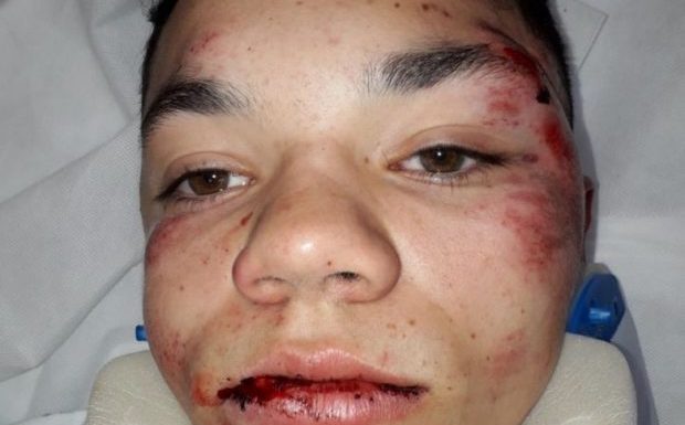 Salon-de-Provence (13) : un jeune boxeur tabassé à la sortie du lycée, le 1 contre 1 se termine en lynchage