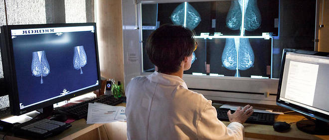 L’IA de Google détecte désormais mieux les cancers du sein que les médecins