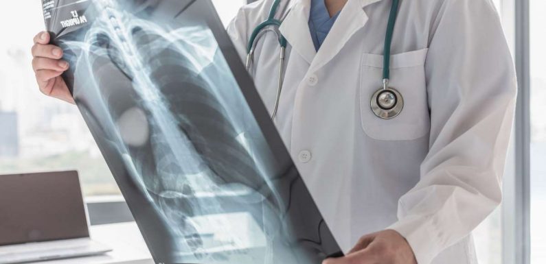 Cancer du poumon : ce symptôme étonnant qu’il faut aussi prendre en compte