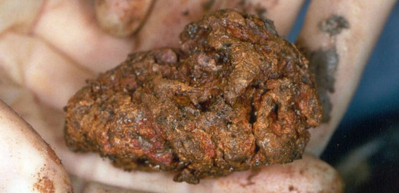 Un morceau de cerveau humain âgé de 2.600 ans est resté presque intact