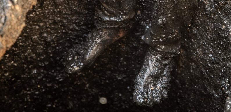 La septicémie associée à un décès sur cinq dans le monde