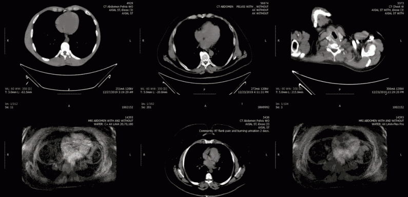 A billion medical images are exposed online, as doctors ignore warnings