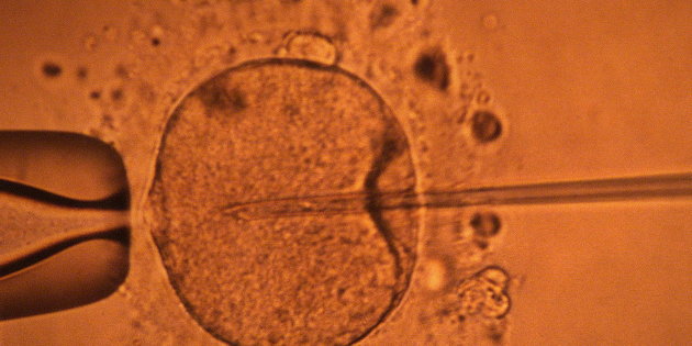 Que savez-vous de la loi de bioéthique ? : l’embryon transgénique