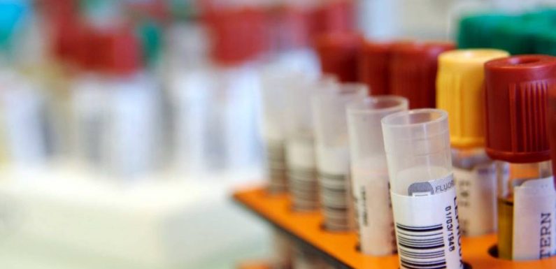 Journée mondiale contre le cancer : Un simple test sanguin pour évaluer la radiosensibilité des patients