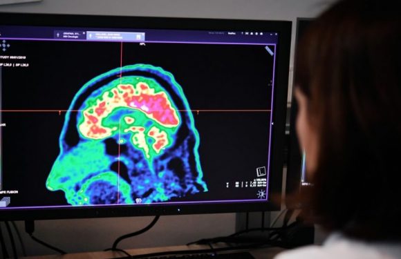 Un Américain retrouve le sens du toucher grâce à un implant cérébral