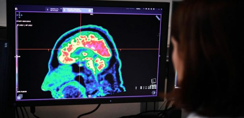 Un Américain retrouve le sens du toucher grâce à un implant cérébral