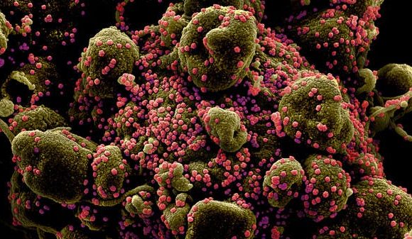 Coronavirus: Two strains, 70 mutations of the virus exist in the UAE, study finds