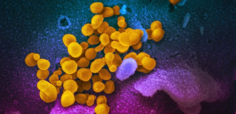 Coronavirus : en Isère, une entreprise invente une toile virucide